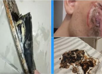 Έσκασε το κινητό του τηλέφωνο στο πρόσωπό του ενώ κοιμόταν