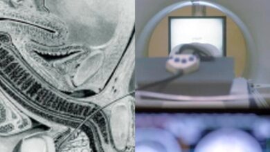 Επιστημονική απεικόνιση της εσωτερικής ανατομίας κατά τη διάρκεια της σεξουαλικής επαφής με τη χρήση μαγνητικής τομογραφίας