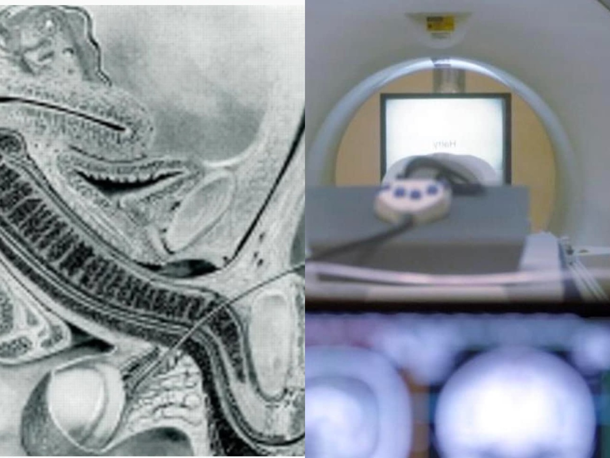 Επιστημονική απεικόνιση της εσωτερικής ανατομίας κατά τη διάρκεια της σεξουαλικής επαφής με τη χρήση μαγνητικής τομογραφίας