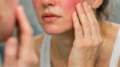 Γυναίκα που παρατηρεί σημάδια κούρασης και κοκκινίλες στο πρόσωπό της μετά από κατανάλωση αλκοόλ