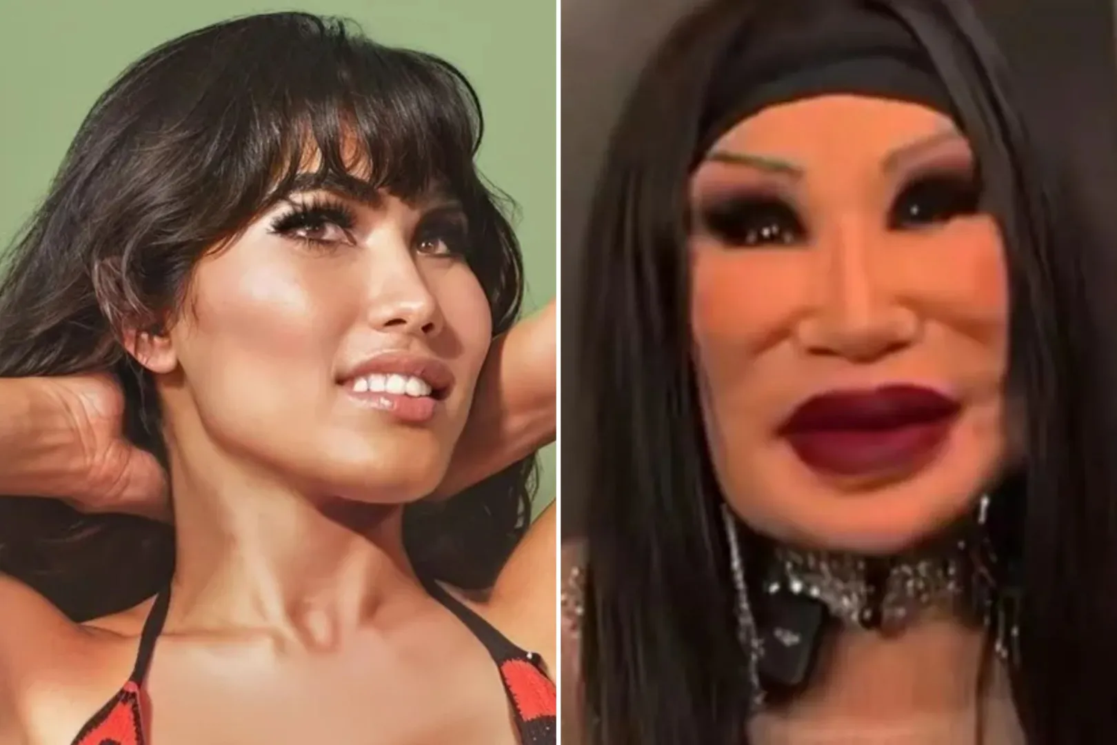 Η ηθοποιός Lyn May με παραμορφωμένο πρόσωπο μετά από αποτυχημένη πλαστική επέμβαση με επικίνδυνα υλικά