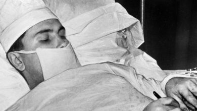 Ο Λεονίντ Ρογκόζοφ τη στιγμή που πραγματοποιεί χειρουργική επέμβαση στον εαυτό του στην Ανταρκτική το 1961