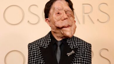 Ο ηθοποιός Άνταμ Πέρσον στο κόκκινο χαλί των Όσκαρ 2026 μιλώντας για τη νευροϊνωμάτωση