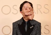 Ο ηθοποιός Άνταμ Πέρσον στο κόκκινο χαλί των Όσκαρ 2026 μιλώντας για τη νευροϊνωμάτωση