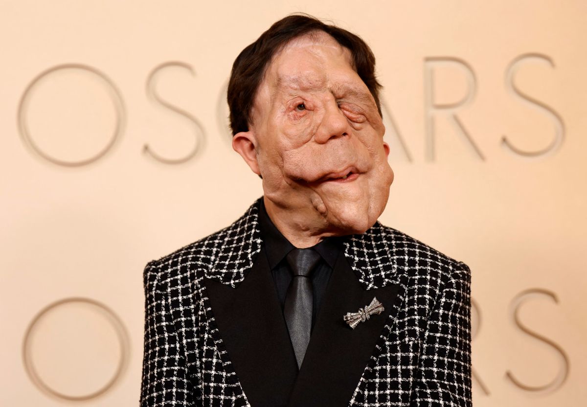 Ο ηθοποιός Άνταμ Πέρσον στο κόκκινο χαλί των Όσκαρ 2026 μιλώντας για τη νευροϊνωμάτωση