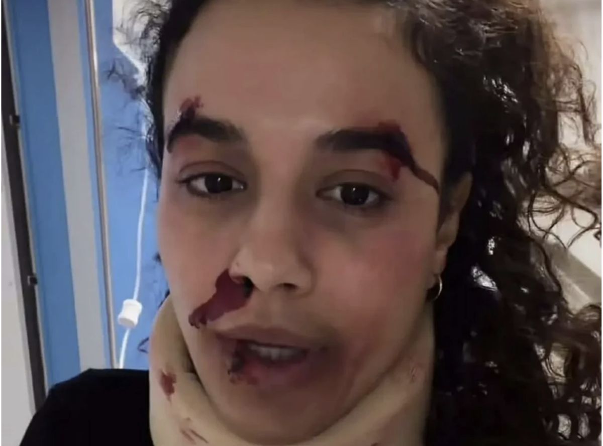 Η ηθοποιός Πηνελόπη Πλάκα με επαγγελματικό μακιγιάζ που προσομοιώνει τραύματα για τη σειρά του Mega