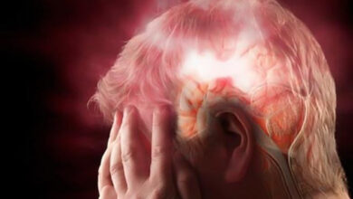 Γραφική απεικόνιση ανευρύσματος στον εγκέφαλο και σημεία πόνου στο κεφάλι.