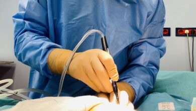 Χειρουργική επέμβαση για μαστεκτομή