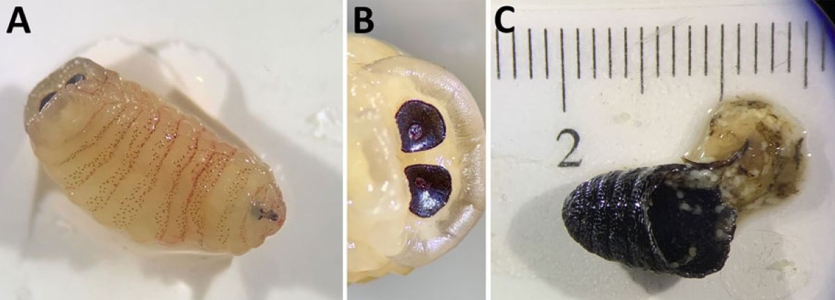 Μικροσκοπική απεικόνιση προνύμφης μύγας Oestrus ovis που προκαλεί ρινική μυΐαση